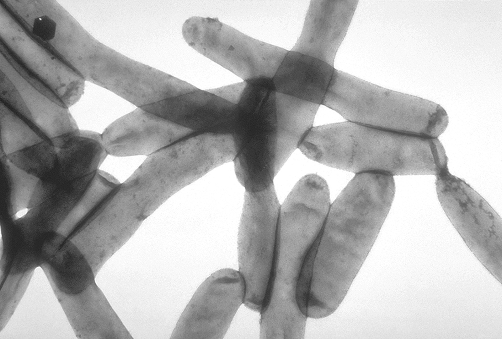 Il batterio Legionella pneumophila al microscopio elettronico.